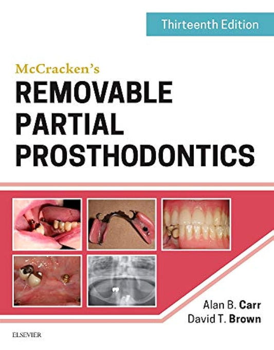McCracken's Removable Partial Prosthodontics 13th Edition